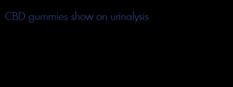 CBD gummies show on urinalysis