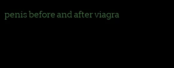 penis before and after viagra